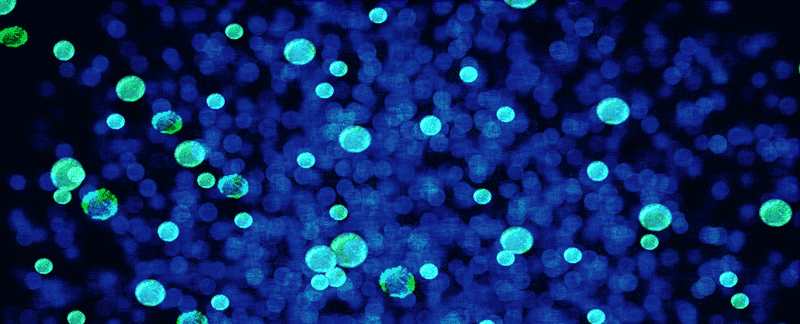 Some cannabinoids have antibacterial qualities - even against antibiotic resistant bacteria