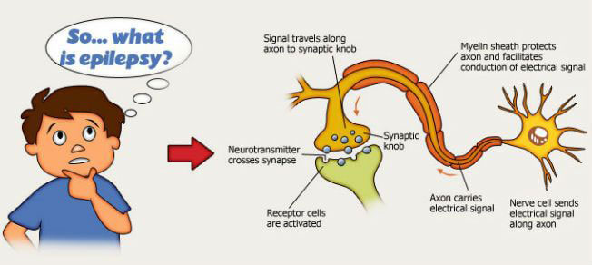 This shows the mechanism activated by underlying causes